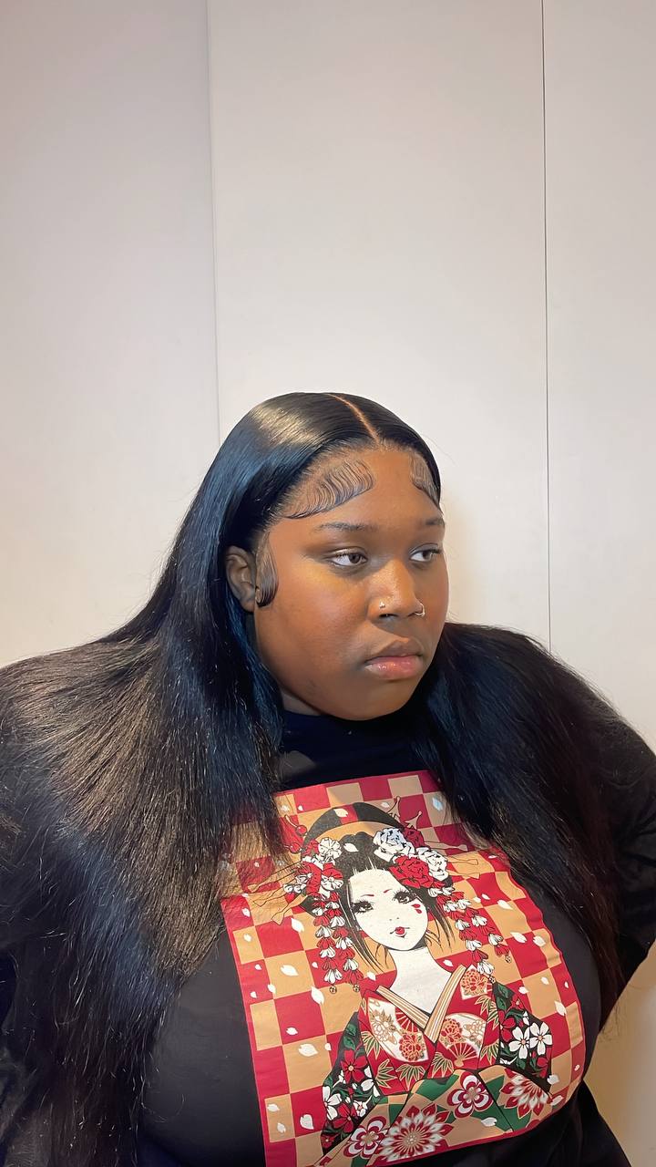 Frontal Installation